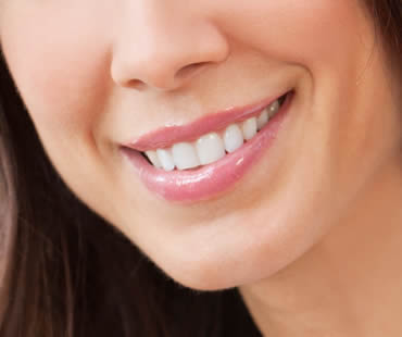 teeth-whitening-dentist.jpg